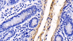 Invitrogen COL1A1 Monoclonal Antibody (C1), Invitrogen 200 &mu;L; Unconjugated:Antibodies,