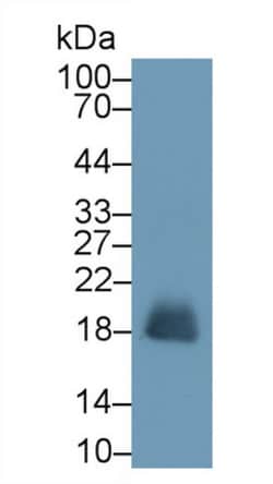 RNASE2 Monoclonal Antibody (C9), Invitrogen:Antibodies:Primary Antibodies