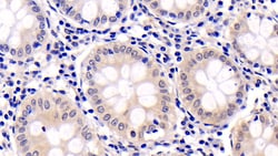ERK2 Monoclonal Antibody (C1), Invitrogen:Antibodies:Primary Antibodies