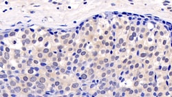 ERK2 Monoclonal Antibody (C1), Invitrogen:Antibodies:Primary Antibodies
