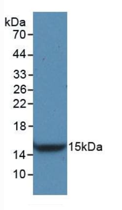Invitrogen VEGFC Monoclonal Antibody (D3), Invitrogen 200 &mu;L; Unconjugated:Antibodies,