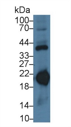 Invitrogen Ferritin Heavy Chain Monoclonal Antibody (C6), Invitrogen:Antibodies:Primary