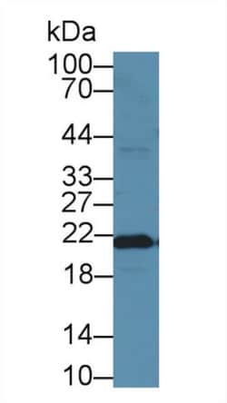 Invitrogen Ferritin Heavy Chain Monoclonal Antibody (C6), Invitrogen 20