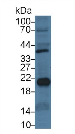 Invitrogen Ferritin Heavy Chain Monoclonal Antibody (C6), Invitrogen:Antibodies:Primary