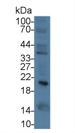 Invitrogen Ferritin Heavy Chain Monoclonal Antibody (C6), Invitrogen:Antibodies:Primary
