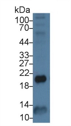 Invitrogen Ferritin Heavy Chain Monoclonal Antibody (C6), Invitrogen:Antibodies:Primary