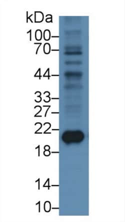 Invitrogen Ferritin Heavy Chain Monoclonal Antibody (C6), Invitrogen:Antibodies:Primary