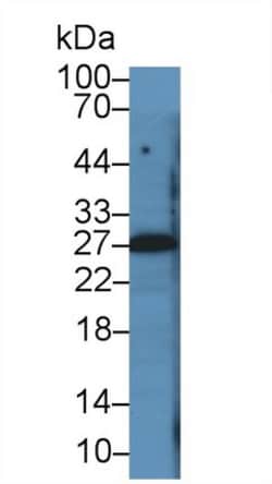 Invitrogen PTHLH Monoclonal Antibody (D1), Invitrogen 200 &mu;L; Unconjugated:Antibodies,