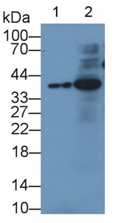 Invitrogen IGFBP3 Monoclonal Antibody (D1), Invitrogen:Antibodies:Primary