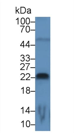 FGF13 Monoclonal Antibody (C1), Invitrogen:Antibodies:Primary Antibodies