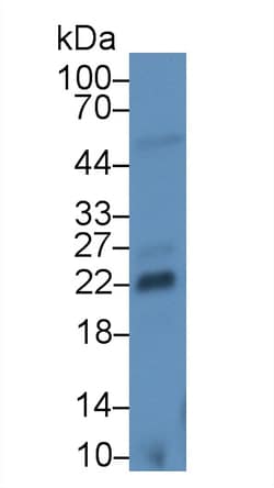 FGF13 Monoclonal Antibody (C1), Invitrogen:Antibodies:Primary Antibodies