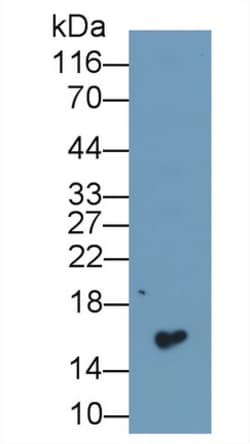 CST1 Monoclonal Antibody (C1), Invitrogen:Antibodies:Primary Antibodies