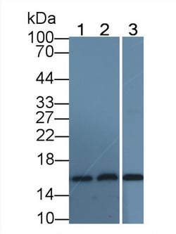 Invitrogen Hemoglobin alpha-1 Monoclonal Antibody (C6), Invitrogen 20 &mu;L;