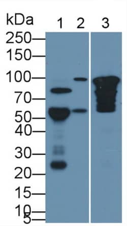 Invitrogen COMP Monoclonal Antibody (C10), Invitrogen:Antibodies:Primary