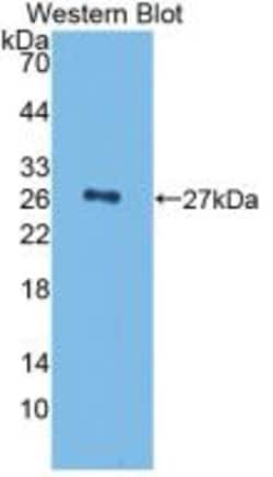 Complement Factor H Monoclonal Antibody (C3), Invitrogen:Antibodies:Primary