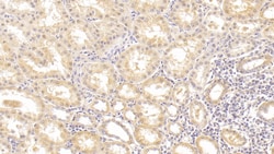 GPT Monoclonal Antibody (C4), Invitrogen:Antibodies:Primary Antibodies