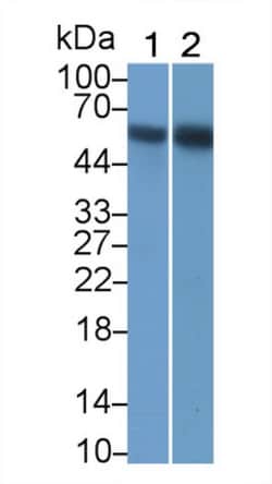 Invitrogen RIP3 Monoclonal Antibody (C1), Invitrogen 20 &mu;L; Unconjugated:Antibodies,