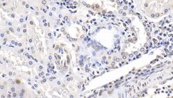 Invitrogen ENO1 Monoclonal Antibody (C2), Invitrogen 20 &mu;L; Unconjugated:Antibodies,