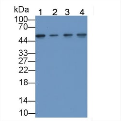 Invitrogen ENO1 Monoclonal Antibody (C2), Invitrogen 20 &mu;L; Unconjugated:Antibodies,