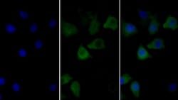 Invitrogen Calnexin Monoclonal Antibody (C2), Invitrogen:Antibodies:Primary