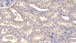 Invitrogen Calnexin Monoclonal Antibody (C2), Invitrogen:Antibodies:Primary