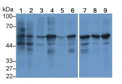 Invitrogen Calnexin Monoclonal Antibody (C2), Invitrogen:Antibodies:Primary