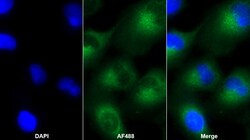 Invitrogen IGFBP-1 Monoclonal Antibody (D3), Invitrogen 200 &mu;L; Unconjugated:Antibodies,