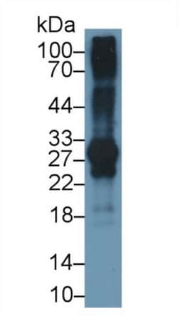 Invitrogen IGFBP-1 Monoclonal Antibody (D3), Invitrogen 200 &mu;L; Unconjugated:Antibodies,