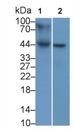 Invitrogen HLA-B Monoclonal Antibody (C1), Invitrogen 20 &mu;L; Unconjugated:Antibodies,