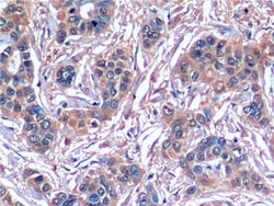 SERPINB3 Monoclonal Antibody (C1), Invitrogen:Antibodies:Primary Antibodies