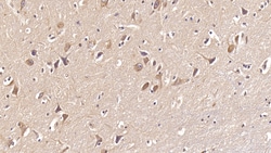 Invitrogen DCLK1 Monoclonal Antibody (C9), Invitrogen:Antibodies:Primary