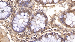 NAMPT Monoclonal Antibody (C8), Invitrogen:Antibodies:Primary Antibodies