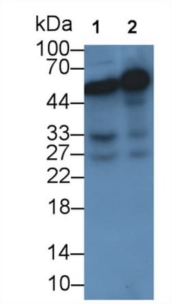 NAMPT Monoclonal Antibody (C8), Invitrogen:Antibodies:Primary Antibodies