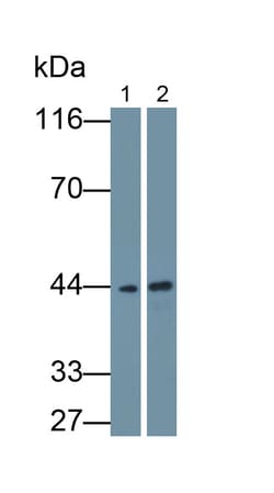 Invitrogen CK1 delta Monoclonal Antibody (C3), Invitrogen 20 &mu;L; Unconjugated:Antikörper