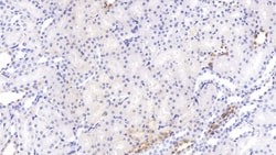 Invitrogen PCSK9 Monoclonal Antibody (C5), Invitrogen:Antibodies:Primary