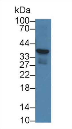 Invitrogen CRHBP Monoclonal Antibody (D2), Invitrogen 20 &mu;L; Unconjugated:Antibodies,