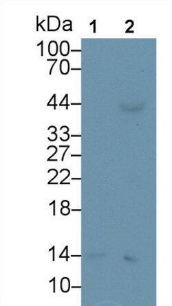 Invitrogen SAA Monoclonal Antibody (D5), Invitrogen 20 &mu;L; Unconjugated:Antibodies,