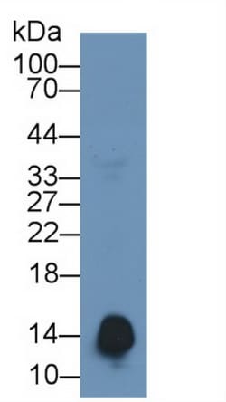 Invitrogen SAA Monoclonal Antibody (D5), Invitrogen 20 &mu;L; Unconjugated:Antibodies,