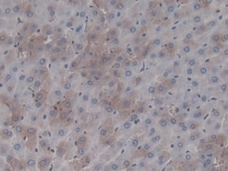 Invitrogen Prothrombin Monoclonal Antibody (C19), Invitrogen 20 &mu;L;