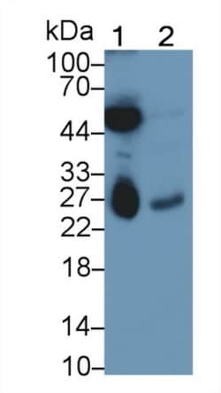 Invitrogen DTYMK Monoclonal Antibody (C17), Invitrogen 200 &mu;L; Unconjugated:Antibodies,