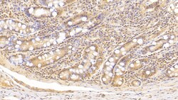 Complement C5a Monoclonal Antibody (D4), Invitrogen:Antibodies:Primary