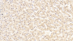 Complement C5a Monoclonal Antibody (D4), Invitrogen:Antibodies:Primary