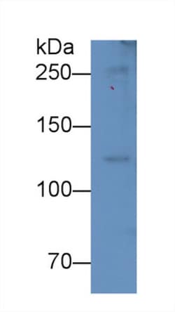 Complement C5a Monoclonal Antibody (D4), Invitrogen:Antibodies:Primary