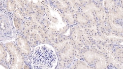 TDO2 Monoclonal Antibody (C10), Invitrogen:Antibodies:Primary Antibodies
