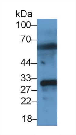 Invitrogen MMP7 Monoclonal Antibody (J9), Invitrogen 20 &mu;L; Unconjugated:Antibodies,