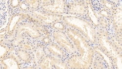 SERPINF2 Monoclonal Antibody (C3), Invitrogen:Antibodies:Primary Antibodies