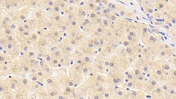 SERPINF2 Monoclonal Antibody (C3), Invitrogen:Antibodies:Primary Antibodies