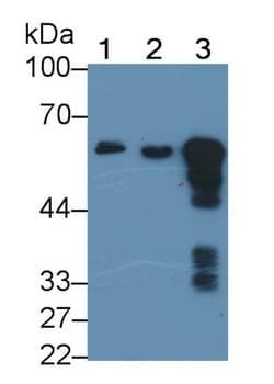 Invitrogen alpha Amylase 1 Monoclonal Antibody (C3), Invitrogen 20 &mu;L;