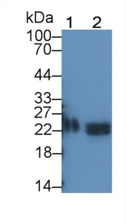 Invitrogen TIMP1 Monoclonal Antibody (C8), Invitrogen:Antibodies:Primary