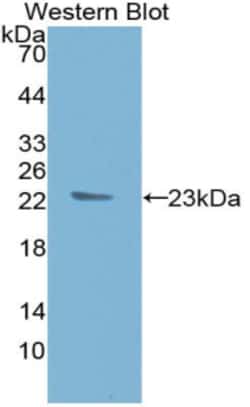 Invitrogen TIMP1 Monoclonal Antibody (C8), Invitrogen:Antibodies:Primary
